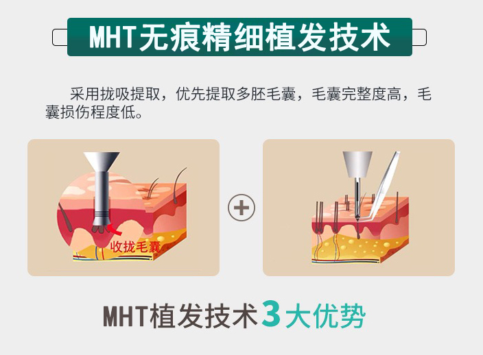 MHTo(w)۾(x)ֲl(f)g(sh)