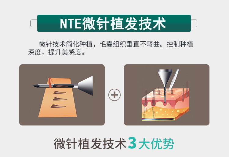 NTE΢ֲl(f)g(sh)